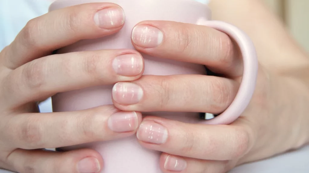 White spots on nails?  Dermatologist secretes