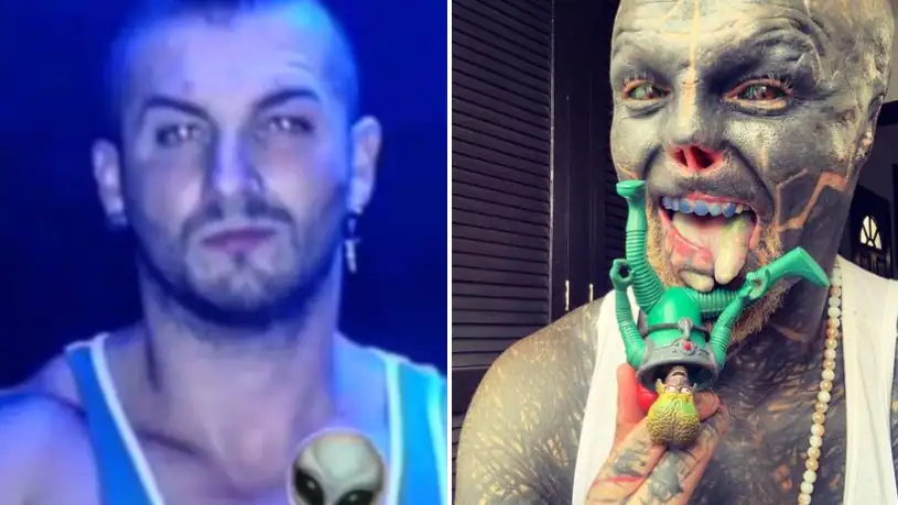 Anthony cut off his nose to look like an alien