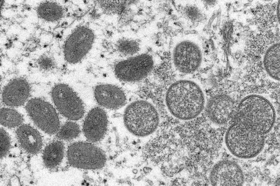 Sweden receives a smallpox vaccine