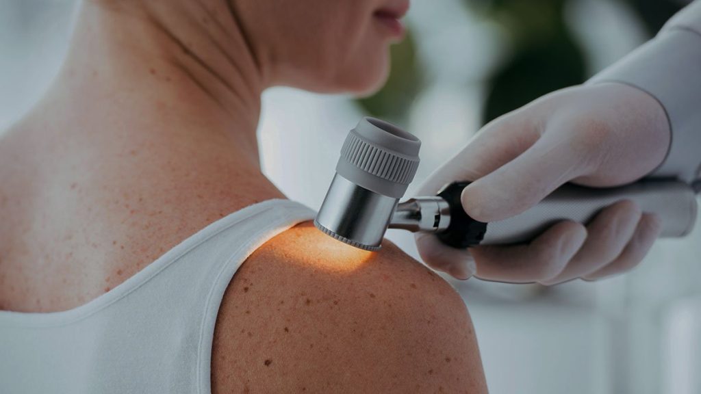 Artificial intelligence assesses the depth of skin cancer as well as dermatologists -