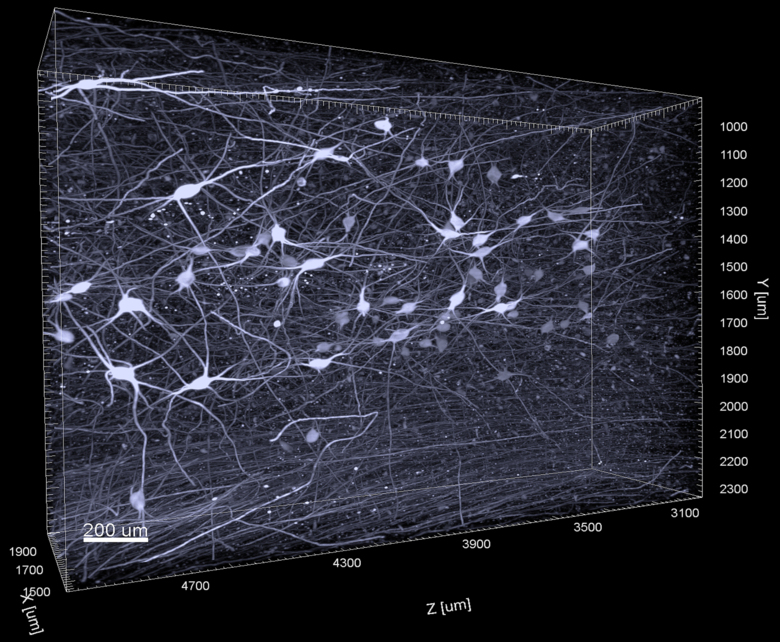 3D imaging contributes to a better understanding of the early stages of Alzheimer's disease