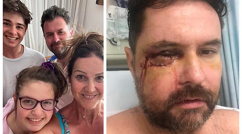 Shaun, 49, attacked by youth gang: 'Teeth were hanging out'